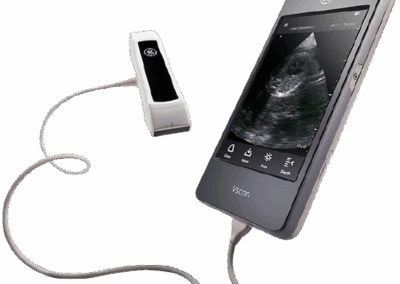 Ecógrafo portatil3
