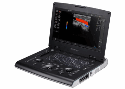 Ecógrafo portatil2